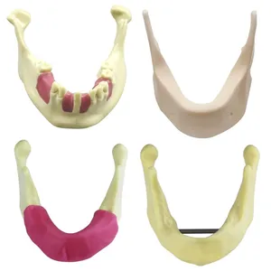 Modelo Dental de Práctica de Implantes, Modelo de Enseñanza de Dientes, Herramienta de Demostración para Entrenamiento Educativo, Modelo de Simulación de Hueso de Mandíbula Inferior - Product Image 1