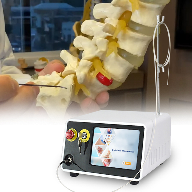 Hot Sale 980nm 1470nm Laser Therapy Pldd Lumbar Disc Pain Relief Laser Device Disc Spine Therapy Device