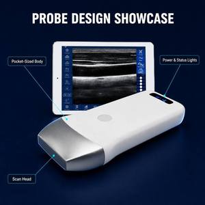 Échographe portable sans fil compatible iOS et Android, sonde Doppler couleur de poche pour l'imagerie abdominale et obstétricale - Product Image 1