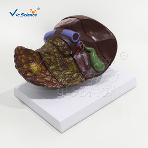 Modelo hepático doente (quatro estágios) hepatite crônica - Product Image 6