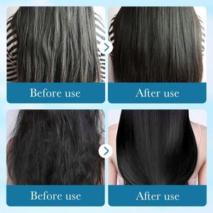 Champú y Acondicionador Capilar Anticaspa <span class=keywords><strong>de</strong></span> Aloe Vera <span class=keywords><strong>de</strong></span> Marca Blanca, el Mejor para el Cuidado del Cabello, Alivia la Picazón - Product Image 6