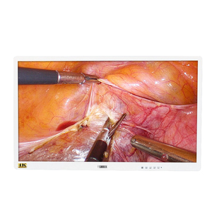 Moniteur de qualité médicale <span class=keywords><strong>55</strong></span> <span class=keywords><strong>pouces</strong></span> grand moniteur d'endoscope <span class=keywords><strong>pc</strong></span> pour laparoscope - Product Image 2