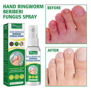Medicina para <span class=keywords><strong>el</strong></span> cuidado de los pies de manos Fórmula suave Spray antifúngico South Moon Hand Tiña Beriberi Fungus Spray 30ML - Product Image 3