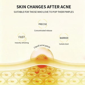 Suero de <span class=keywords><strong>Azufre</strong></span> Coloidal de Marca Privada para <span class=keywords><strong>el</strong></span> Acné, Corrector de Manchas Oscuras, Minimizador de Poros, Control de Grasa, Suero Facial Iluminador OEM - Product Image 3