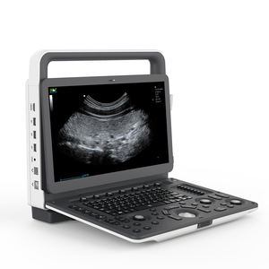 MSLCU77 컬러 도플러 초음파는 소노스케이프 E3 초음파 스캐너와 유사합니다. - Product Image 2