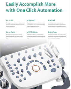 Sonosbape mesin <span class=keywords><strong>Ultrasound</strong></span>, Sonoscape P20 4D 5D troli warna Doppler - Product Image 5