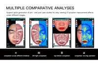 Meilleur objectif de microscope analyseur de peau 3D, pour appareil d'analyse de la peau du visage AIMYSKIN