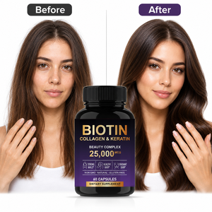 Capsule di Biotina <span class=keywords><strong>e</strong></span> Collagene all'Ingrosso, Integratore di Biotina, <span class=keywords><strong>Vitamine</strong></span> per <span class=keywords><strong>Capelli</strong></span>, <span class=keywords><strong>Unghie</strong></span> <span class=keywords><strong>e</strong></span> Pelle, Capsule per il Supporto di <span class=keywords><strong>Capelli</strong></span>, Pelle <span class=keywords><strong>e</strong></span> <span class=keywords><strong>Unghie</strong></span> - Product Image 3