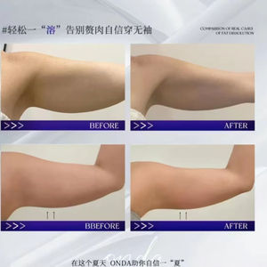 <span class=keywords><strong>Appareil</strong></span> de remodelage corporel par ondes froides <span class=keywords><strong>efficace</strong></span> pour lutter contre le vieillissement, améliorer le relâchement cutané et éliminer le double menton - Product Image 3