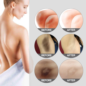 Crème éclaircissante végane à la vitamine E pour les zones sensibles des femmes, éclaircissant les taches brunes, nourrissante, crème pour les aisselles, 30g - Product Image 4