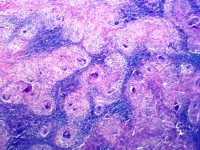 10/20/25/30/50/100/200 Buah Slide Histologi Patologis Mikroskop Manusia Edukatif, Slide Histologi Siap Pakai CE\ISO