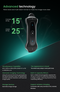 TOP1 <span class=keywords><strong>yonker</strong></span> PAU2B อุปกรณ์ตรวจวัดทางสัตวแพทย์ USB PICC ไร้สายโพรบอัลตร้าซาวด์เชิงเส้นนูนโพรบสมาร์ทโฟนที่ใช้ - Product Image 5