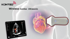 कोटेड एमडीआर उच्च गुणवत्ता वाले चिकित्सा अल्ट्रासाउंड उपकरण रंग डॉपलर वायरलेस और यूएसबी चरणबद्ध सरणी जांच - Product Image 3