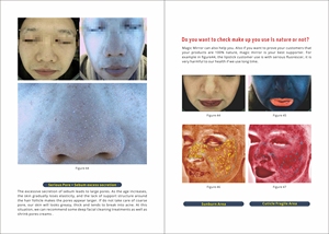 AI Automatic HD 7-inch Touchscreen Wrinkle Removing Facial & Body Skin Analyzer with 3D Analysis Technology - Product Image 6