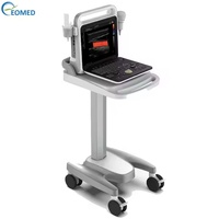 Taşınabilir Çelik Diagnostik Ekokardiyografi Ultrason Cihazı Ekograf Cihazı Renkli Doppler CU60B Dahili Bataryalı 1 Yıl Garantili