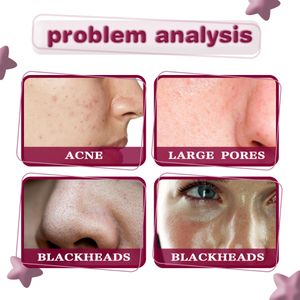 Jaysuing Acid Essence reduce los poros elimina los puntos negros, espinillas y marcas de acné ilumina el tono de la piel hidratante - Product Image 2