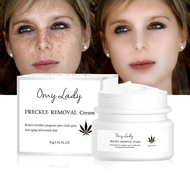 Omy lady – nouvelle ligne de soins de la peau, crème pour le visage à fonction de résultats rapides pour éliminer la pigmentation et les coups de soleil, 2023