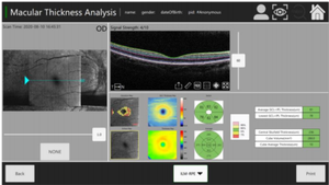 Tomografía de Coherencia Ó<span class=keywords><strong>ptica</strong></span> OCT-500 de Alta Precisión y Tecnología Avanzada, Mejor Precio, Gran Venta - Product Image 4
