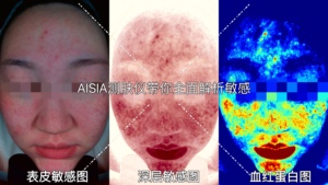 Máquina de Análisis Facial 3D, Analizador de Piel Facial, Máquina de Análisis de Piel Aisia - Product Image 5