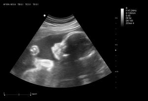 Ecógrafo Veterinario Zoncare Viv 60 con <span class=keywords><strong>Precio</strong></span> Económico, Doppler Color 3D y 4D con Carro para Hospital Veterinario - Product Image 4