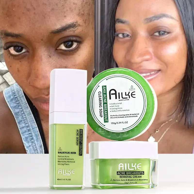 Commercio all'ingrosso sbiancamento ringiovanire le donne di bellezza viso Anti-Acne controllo olio incandescente trattamento cura della pelle Set per tutti i tipi di pelle