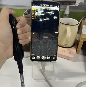 Hitam dan putih kabel <span class=keywords><strong>USB</strong></span> transmainan Ultrasound 80 elemen mesin Ultrasound untuk sapi/kuda - Product Image 2