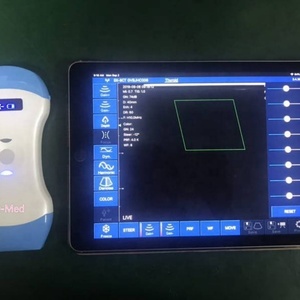 Sonde échographique portable 3-en-1 sans fil pour smartphone, Doppler linéaire, échographie médicale sans fil DCU19E - Product Image 2