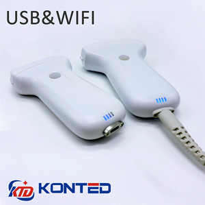 स्मार्ट फोन/एंड्रॉइड कंप्यूटर कनेक्ट वायरलेस यूएसबी जांच हैंडहेल्ड वायरलेस अल्ट्रासाउंड - Product Image 5