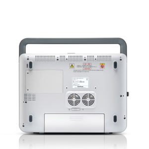 Sistema de máquina de ultrasonido médico Doppler color portátil ecocardiografía Sonoscape X5 - Product Image 4