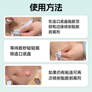 Haiss Hainuo Ostomy Adhesive Remover <b>Spray</b> 60ml Skin Protector For Damaged Skin Adults - Product Image 5