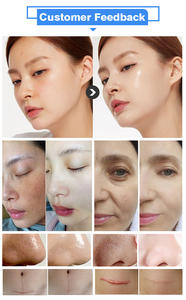 Máquina de hidrodermoabrasión Jet Peel 11 en 1 de fábrica china, la máquina de belleza más popular para el cuidado de la piel, antienvejecimiento, para SPA y salón de belleza. - Product Image 6