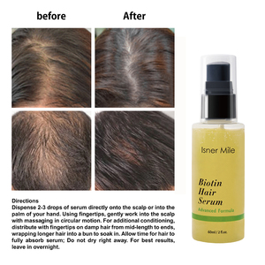 Suero para el Crecimiento del <span class=keywords><strong>Cabello</strong></span> con <span class=keywords><strong>Biotina</strong></span> OEM, Tónico Capilar, Suero para el Cuidado del <span class=keywords><strong>Cabello</strong></span>, <span class=keywords><strong>Cabello</strong></span> Sano y Fuerte, Apto para <span class=keywords><strong>Hombres</strong></span> y Mujeres - Product Image 2