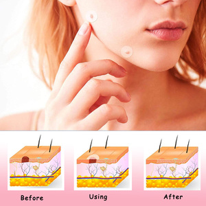 Nhãn Hiệu Riêng OEM Chữa Bệnh Loại Bỏ Không Thấm Nước Mụn Trứng Cá Hấp Thụ Bìa Vá Hydrocolloid Mụn Mụn Mụn Vá Tại Chỗ - Product Image 5