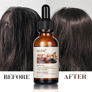 Serum Minyak Rambut Organik Vegan Jahe <span class=keywords><strong>Keratin</strong></span> Label Pribadi Anti-Rontok, Perangsang Pertumbuhan Kembali, Perawatan Menutrisi Tanpa Bilas untuk Penggunaan di Rumah - Product Image 1