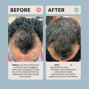Shampoo nourrissant pour le cuir chevelu à base de plantes OEM, shampooing anti-chute de <span class=keywords><strong>cheveux</strong></span>, shampooing volumisant adapté aux <span class=keywords><strong>cheveux</strong></span> <span class=keywords><strong>clairsemés</strong></span> <span class=keywords><strong>et</strong></span> gras, aux <span class=keywords><strong>cheveux</strong></span> abîmés - Product Image 4