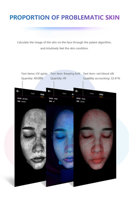 Analyseur de Peau Intelligent 3D Professionnel 2026 pour le Visage : Scanner Anti-Rides et Anti-Acné avec IA Intégrée pour Soins du Visage