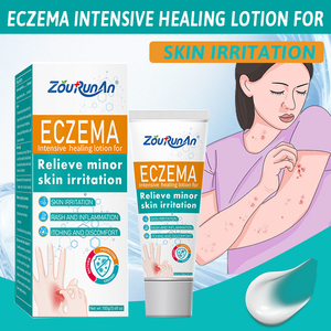 Ungüento para Psoriasis, Eccema, Alergias, Picazón, Salud de la Piel, Erupciones, Ungüento para Eccema para la Piel del Cuerpo - Product Image 4