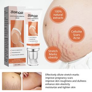 Meilleure vente Formule végétalienne Crème réparatrice pour les vergetures à action rapide, douce et non irritante pour une peau lisse du corps - Product Image 5