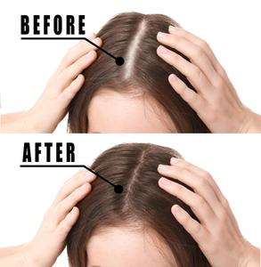 Private Label Polygonum Multiflorum Root Extract Effective Fast Hair <strong>Growth</strong> Treatment Hair Oils for Hair <strong>Growth</strong> - Product Image 6