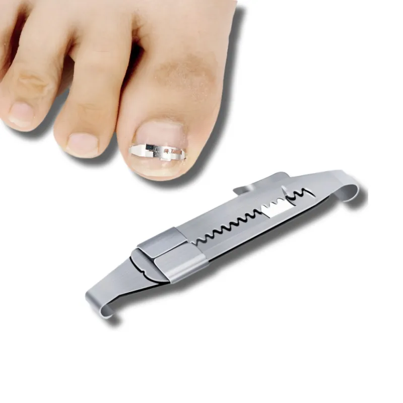 Muestras gratis Corrector de uñas de los pies Herramienta para el cuidado de las uñas Clip alisador Curvo Brace Uñas DE LOS PIES Corrección de paroniquia gruesa Cuidado de los pies