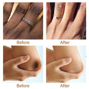 Suero para el Cuidado de la Piel, Tratamiento para Aclarar y Eliminar Manchas Oscuras en las Articulaciones de Rodillas, Codos y Dedos - Product Image 4