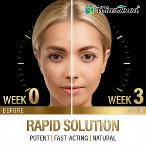 Private Label Skin Acne support capsules niacinamide probiotic vitamin A clear skin care natural dietary supplement capsulies - Product Image 2