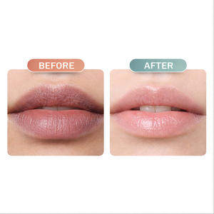 Crema Nutritiva para Labios Oscuros al por Mayor, Hidrata, Reduce las Líneas de los Labios, Bálsamo Suavizante para Labios Oscuros - Product Image 4
