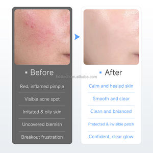 Stiker anti noda bulat transparan, tempelan untuk perawatan jerawat hidrokoloid tidak terlihat 36 buah - Product Image 5