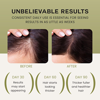Ramuan Herbal Minyak Argan Rosemary Elixir Pertumbuhan Mega Perawatan Rambut Alami Organik Minyak Rosemary untuk Kekuatan Rambut