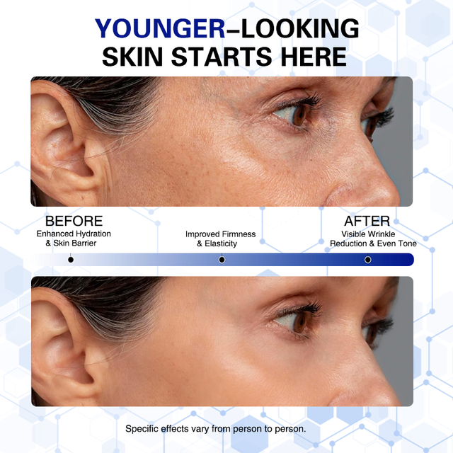 ghk-cu before and after ✨ Glow from the inside out. GLOW Peptide Therapy is a powerful blend of  BPC-157, TB-400, and GHK-Cu designed to support collagen production, soften  the appearance of fine lines, and improve skin main image 1