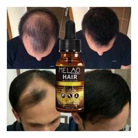 Huile Capillaire Fortifiante et Réparatrice à l'Huile d'Argan Bio, Sérum Naturel Anti-Chute Unisexe, Gouttes de Croissance Rapide à la Biotine, Marque Privée