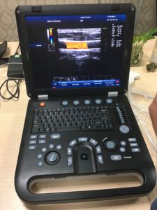 Ecografo Doppler a Colori HD Professionale SUN 906A per Diagnosi di Malattie degli Animali <span class=keywords><strong>da</strong></span> Allevamento - Product Image 3