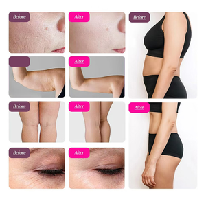 Xách tay 30k Cavi Trọng lượng giảm cân thiết bị cơ thể điêu khắc mặt nâng máy 30kHz Cavi cơ thể Giảm béo máy - Product Image 6