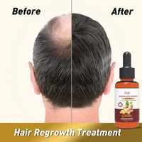 Sérum Capillaire Bio Personnalisé au Gingembre pour la Croissance des Cheveux – Huiles Capillaires Liquides Hydratantes pour Cheveux Bouclés (Hommes et Femmes) – Marque Privée